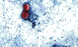 ABD'deki Cyclospora Salgını Türkiye İçin De Uyarı Oldu