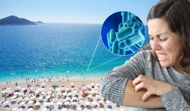 Avrupa Hastalık Önleme ve Kontrol Merkezinden Alanya’da ‘Et Yiyen Bakteri’ Uyarısı