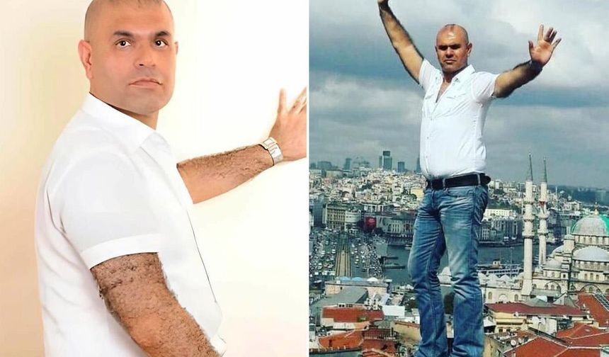 50 Milyon Euro İstemişti! Ajdar Kaos Show’a Katıldı